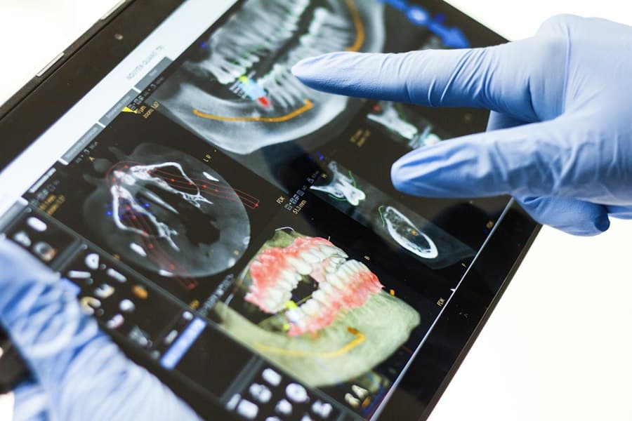 3D dental scan